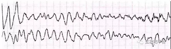 救命神器AED有多重要——你认识它吗？(图5)